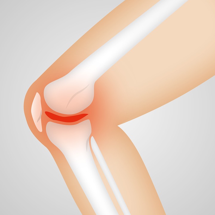You are currently viewing Je li artritis uzrok bola u koljenu ili je to nešto drugo?